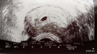 Bild zu an die mehrling Mamas - Schwanger - wer noch? Rund um die Schwangerschaft