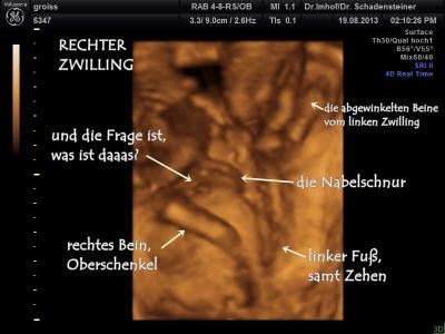 Bild zu Geschlecht raten - Mädels, was seht ihr? - Schwanger - wer noch? Rund um die Schwangerschaft
