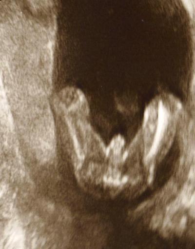 Bild zu Ultraschall-Foto - Hilfe bei Geschlecht! - Schwanger - wer noch? Rund um die Schwangerschaft