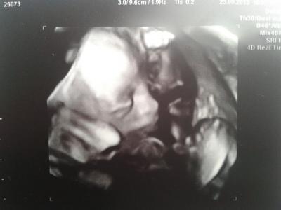 Bild zu Erfahrung mit Baby-TV 3D, wenn.... - Schwanger - wer noch? Rund um die Schwangerschaft