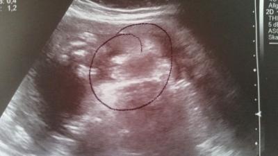 Bild zu Outingbild: Welches Geschlecht erkennt ihr? - Schwanger - wer noch? Rund um die Schwangerschaft