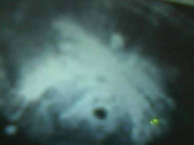 Bild zu welche ssw ist das? - Schwanger - wer noch? Rund um die Schwangerschaft
