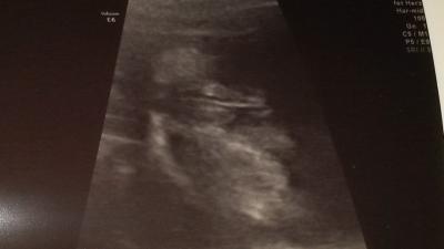 Bild zu geschlecht erkennbar??? - Schwanger - wer noch? Rund um die Schwangerschaft