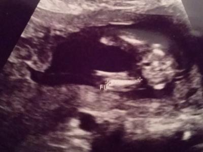 Bild zu Outing - Schwanger - wer noch? Rund um die Schwangerschaft