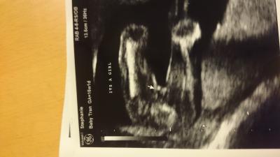 Bild zu Es ist ein Mädchen :D - Schwanger - wer noch? Rund um die Schwangerschaft