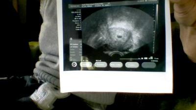 Bild zu muss euch mal was zeigen 5+1 - Schwanger - wer noch? Rund um die Schwangerschaft