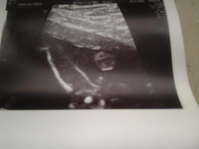 Bild zu Mädchen oder doch Junge? - Schwanger - wer noch? Rund um die Schwangerschaft