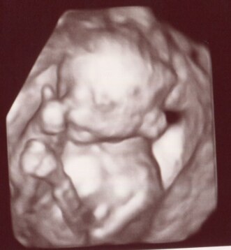 Bild zu Ultraschallbild... noch garnicht auf der Welt aber... - Schwanger - wer noch? Rund um die Schwangerschaft