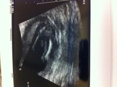 Bild zu Habt ihr Jungs outing Bilder? - Schwanger - wer noch? Rund um die Schwangerschaft