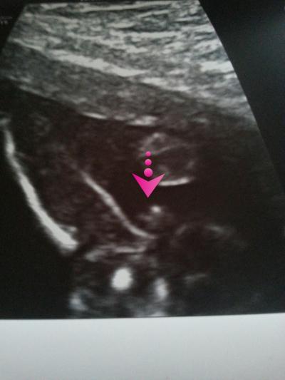 Bild zu Für alle die mitgeraten haben :-) - Schwanger - wer noch? Rund um die Schwangerschaft