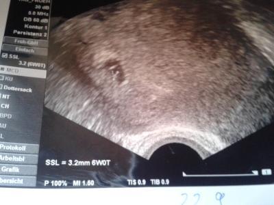 Bild zu Mein Arzt Termin war erfolgreich - Schwanger - wer noch? Rund um die Schwangerschaft