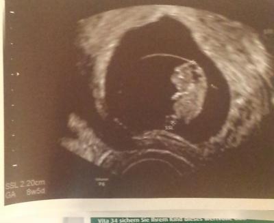 Bild zu Ungeduuuld! - Schwanger - wer noch? Rund um die Schwangerschaft