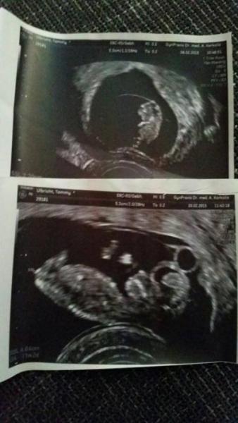 Bild zu Stolz wie ein Löwe ! :)))) - Schwanger - wer noch? Rund um die Schwangerschaft