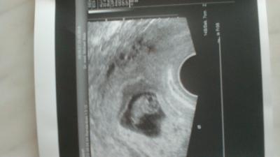 Bild zu Total Happy :-) - Schwanger - wer noch? Rund um die Schwangerschaft