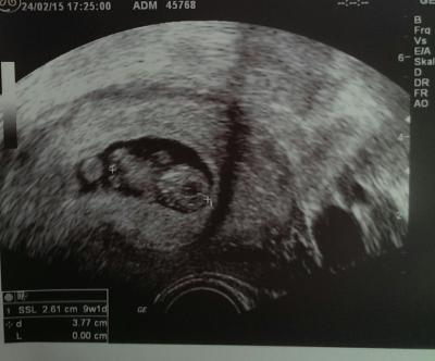 Bild zu Silopo - Schwanger - wer noch? Rund um die Schwangerschaft