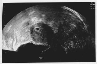 Bild zu Frage an die Profis - Schwanger - wer noch? Rund um die Schwangerschaft