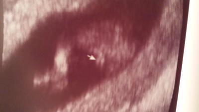 Bild zu Junge oder Mädchen was meint ihr? - Schwanger - wer noch? Rund um die Schwangerschaft