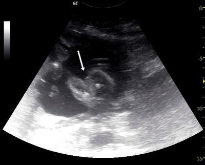 Bild zu Junge oder Mädel ? - Schwanger - wer noch? Rund um die Schwangerschaft