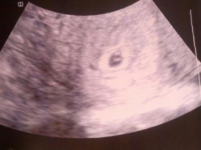 Bild zu Hallo an alle Mamis! - Schwanger - wer noch? Rund um die Schwangerschaft