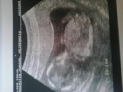 Bild zu Geschlechts Erkennung :) - Schwanger - wer noch? Rund um die Schwangerschaft