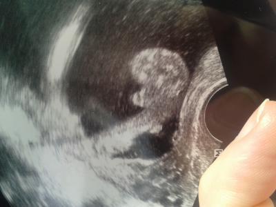 Bild zu outing und us bild sicher? - Schwanger - wer noch? Rund um die Schwangerschaft