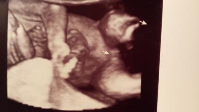 Bild zu Was meint ihr :-) - Schwanger - wer noch? Rund um die Schwangerschaft