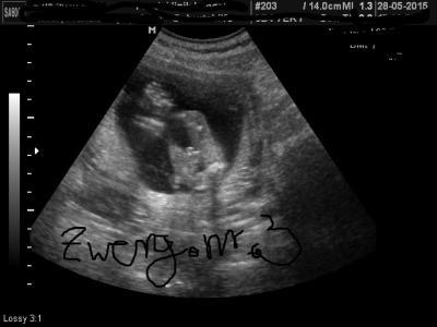 Bild zu Junge oder Mädchen? - Schwanger - wer noch? Rund um die Schwangerschaft