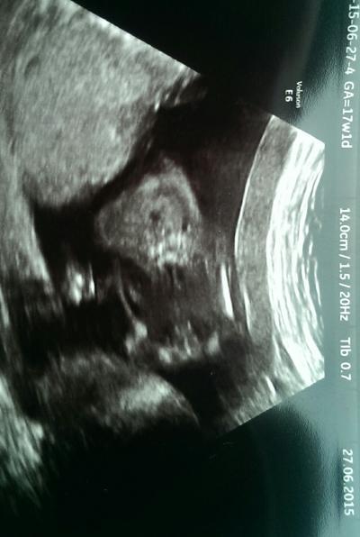 Bild zu Outing sicher? - Schwanger - wer noch? Rund um die Schwangerschaft