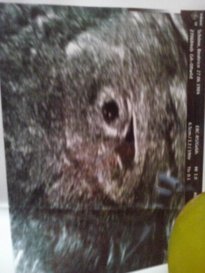 Bild zu Bitte mal schauen eins oder zwei ? - Schwanger - wer noch? Rund um die Schwangerschaft