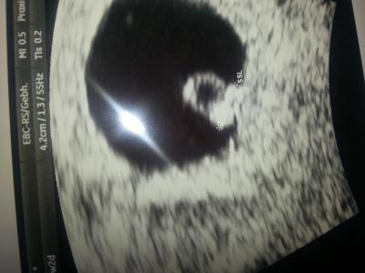 Bild zu darf ich vorstellen?? - Schwanger - wer noch? Rund um die Schwangerschaft