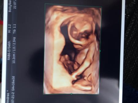 Bild zu Wirklich ein Junge?! - Schwanger - wer noch? Rund um die Schwangerschaft