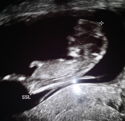 Bild zu seltsames US-Bild - Schwanger - wer noch? Rund um die Schwangerschaft