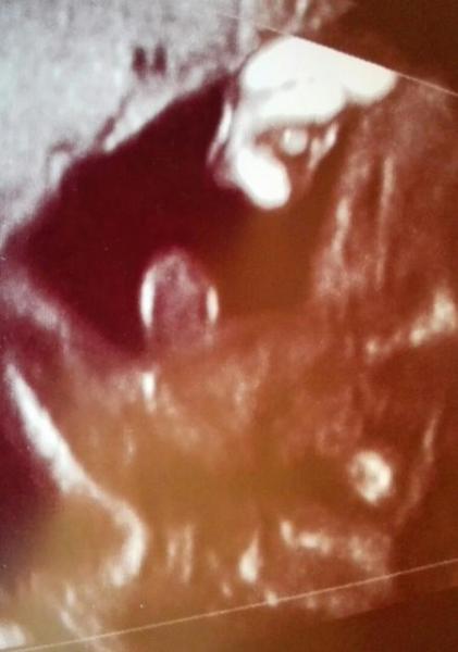 Bild zu Outing aber dennoch Zweifel ;-) - Schwanger - wer noch? Rund um die Schwangerschaft