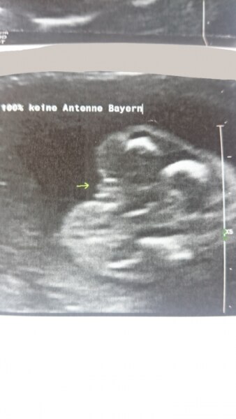 Bild zu Wollte euch mal berichten - Schwanger - wer noch? Rund um die Schwangerschaft