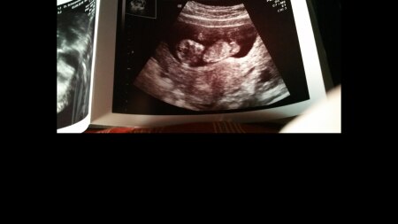 Bild zu outing? Ist das dass geschlecht? - Schwanger - wer noch? Rund um die Schwangerschaft