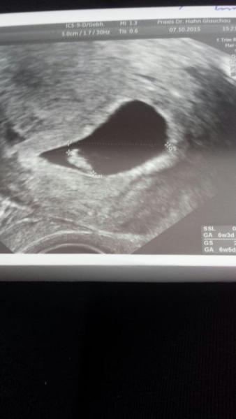 Bild zu Sie aus wie ein Papagei :)))))) - Schwanger - wer noch? Rund um die Schwangerschaft