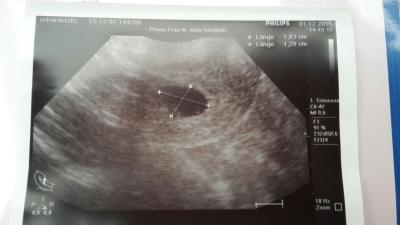 Bild zu Ist das etwas? - Schwanger - wer noch? Rund um die Schwangerschaft