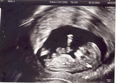 Bild zu Junge oder Mädchen, was meint ihr? - Schwanger - wer noch? Rund um die Schwangerschaft