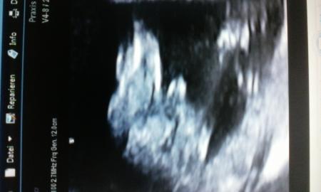 Bild zu Outing schon in der 16 Ssw - Schwanger - wer noch? Rund um die Schwangerschaft