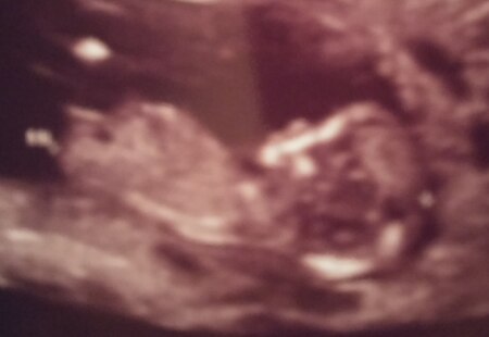 Bild zu An die Mädchen- Mamis - Schwanger - wer noch? Rund um die Schwangerschaft