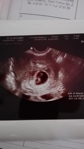 Bild zu Zurück vom Frauenarzt....bild....und lob an euch - Schwanger - wer noch? Rund um die Schwangerschaft