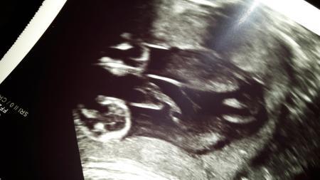 Bild zu Mädchen Outing? ?? - Schwanger - wer noch? Rund um die Schwangerschaft