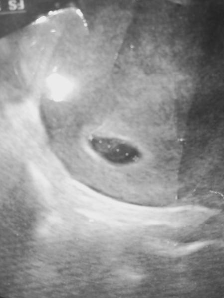 Bild zu Zwillinge??US-Bild - Schwanger - wer noch? Rund um die Schwangerschaft