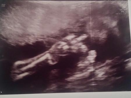 Bild zu Kleiner frechdachs - Schwanger - wer noch? Rund um die Schwangerschaft