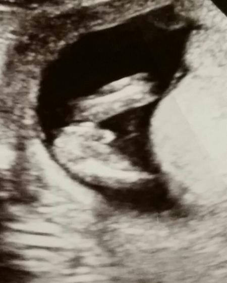 Bild zu Junge oder Mädchen - Schwanger - wer noch? Rund um die Schwangerschaft