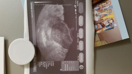 Bild zu 1. Ultraschall Termin 5. Woche - Schwanger - wer noch? Rund um die Schwangerschaft