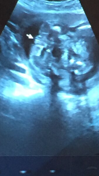 Bild zu Geschlechtsouting - Schwanger - wer noch? Rund um die Schwangerschaft