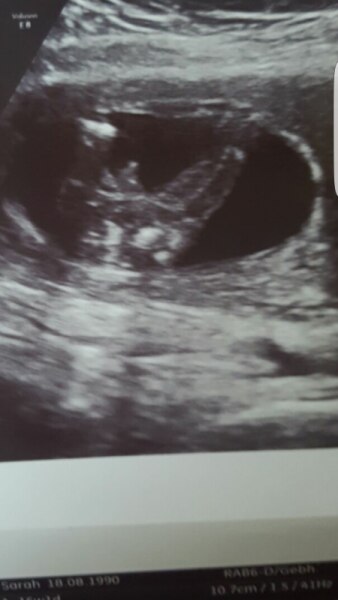 Bild zu Geschlecht - Schwanger - wer noch? Rund um die Schwangerschaft