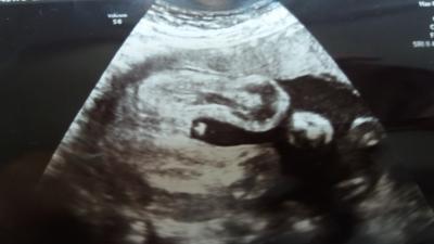 Bild zu junge?? - Schwanger - wer noch? Rund um die Schwangerschaft