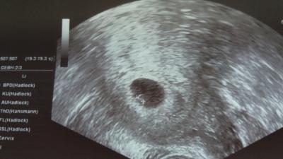 Bild zu Kann hier jemand - Schwanger - wer noch? Rund um die Schwangerschaft